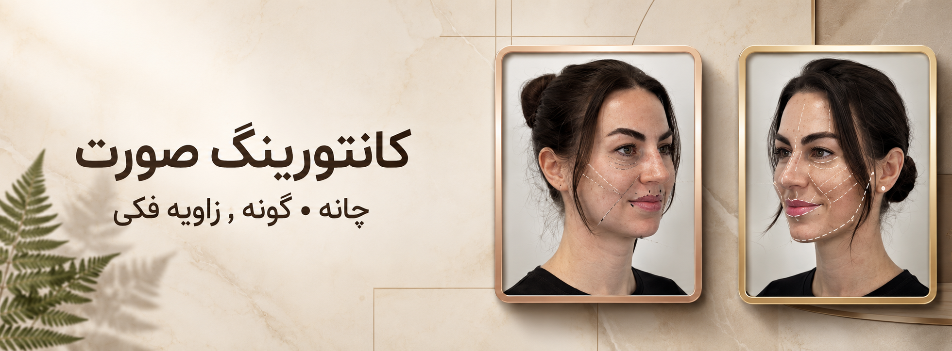 3 بنر فروشگاه