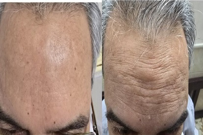 5 بنر فروشگاه