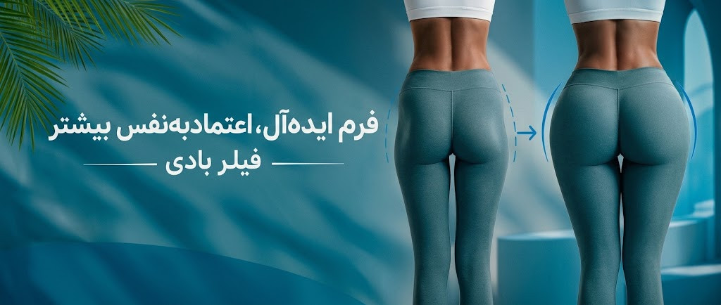 5 بنر فروشگاه