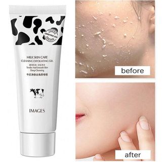 ژل لایه بردار شیرگاو