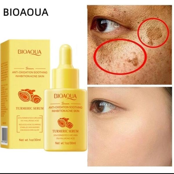 سرم معجزه گر زردچوبه بیوآکوا