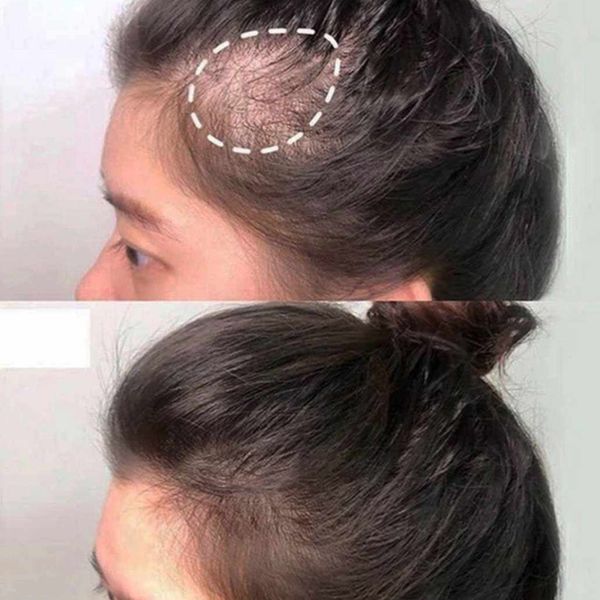 شامپو ضدریزش رزماری