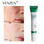 پماد ضد جوش سالیسیک اسید ونزن