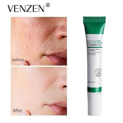 پماد ضد جوش سالیسیک اسید ونزن