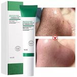 پماد ضد جوش سالیسیک اسید ونزن