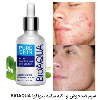 سرم ضدجوش و آکنه بیواکوا