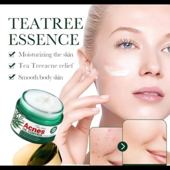 کرم ضدجوش چای سبز سادور