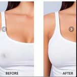 پد چسبی نیپل نامرئی پوشاننده نوک سینه