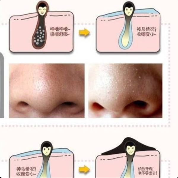 چسب بینی اورجینال