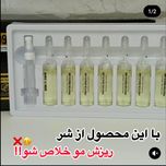 ویال مو