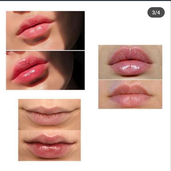 حجم دهنده لب