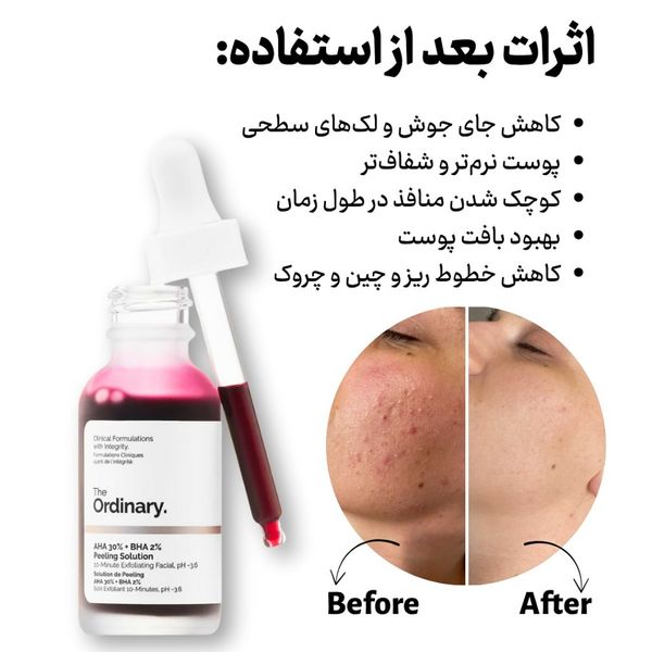 سرم پیلینگ اوردینری