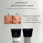 پرایمر گابرینی اصلی