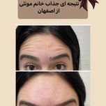 کرم نرم کننده ویتابلا مدل جوانه گندم حجم 180 میلی لیتر