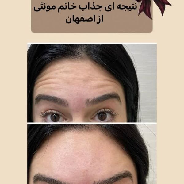 کرم نرم کننده ویتابلا مدل جوانه گندم حجم 180 میلی لیتر