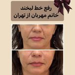 سرم سفت‌کننده و تغذیه‌کننده گاتیو مدل کلاژن مناسب برای انواع پوست حجم 30 میلی‌لیتر