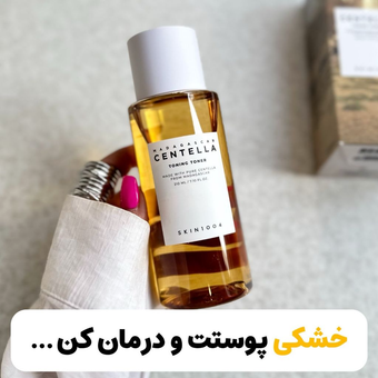 تونر سنتلا