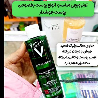 تونر ضدجوش ویشی