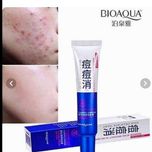 کرم ضد جوش فوری حجم 30 میلی لیتر