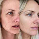 سرم آلفا آربوتین اورینری