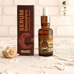 سرم دور چشم