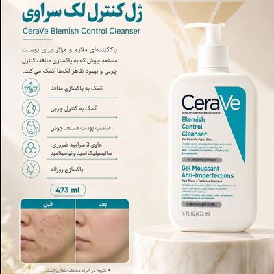 ژل ضد جوش و کنترل لک سراوی 473میل
