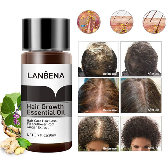 قطره رشد مو لانینا