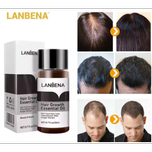 قطره رشد مو لانینا