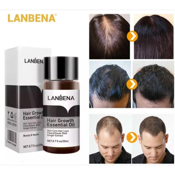 قطره رشد مو لانینا