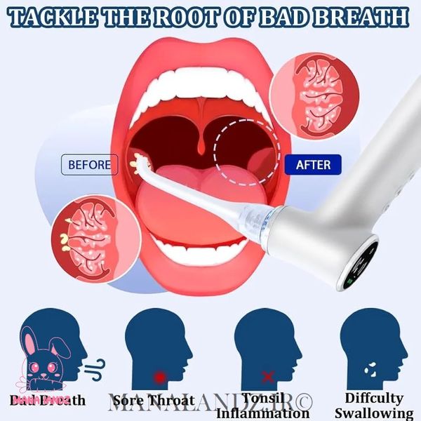 دستگاه سنگ لوزه کیت کامل