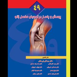 49 پرسش و پاسخ در تعویض مفصل زانو