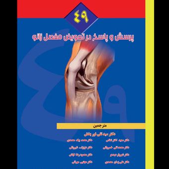 49 پرسش و پاسخ در تعویض مفصل زانو