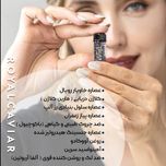 کرم خاویار تراست اسمارت