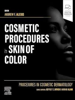 Procedures in Cosmetic Dermatology: Cosmetic Procedures in Skin of Color 2024