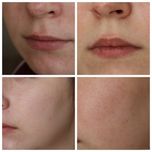 کرم ترمیم کننده سیکالفیت پلاس اون Avene Cicalfate Repairing Protective Cream