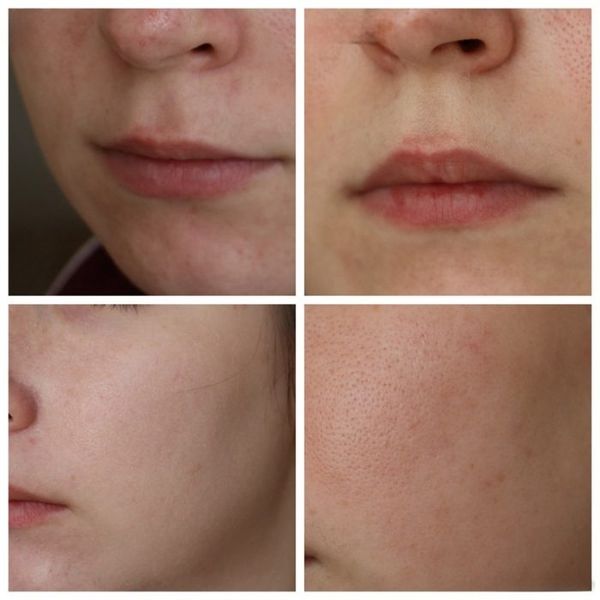 کرم ترمیم کننده سیکالفیت پلاس اون Avene Cicalfate Repairing Protective Cream
