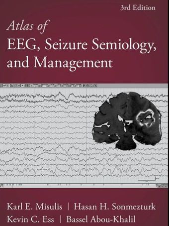 Atlas of EEG, Seizure Semiology, and Management 2022