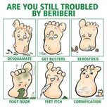 اسپری گیاهی ضدبو و درمان زخم پا حجم 30 میلی لیتر