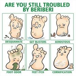اسپری گیاهی ضدبو و درمان زخم پا حجم 30 میلی لیتر