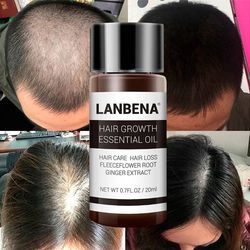 روغن رشد.   مو و ریش لانبنا LANBENA دنبال رشد مجدد مو و ریش هستی؟ 🤔 لانبنا (LANBENA) جوابته! 🔥