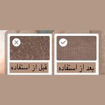 پرزگیر برقی لباس