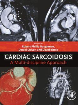 Cardiac Sarcoidosis: A Multi-discipline Approach 2025 1st Edition