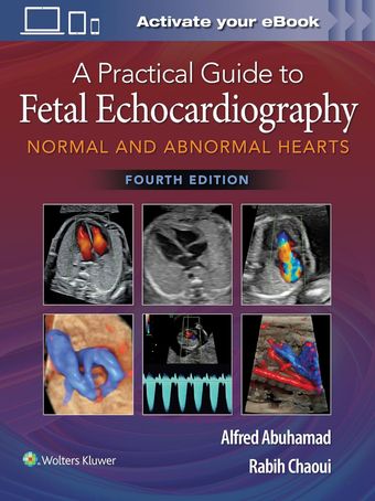 A Practical Guide to Fetal Echocardiography: Normal and Abnormal Hearts 2022