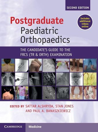 Postgraduate Paediatric Orthopaedics: The Candidate's Guide to the FRCS(Tr&Orth) Examination 2025 2nd Edition