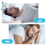 کیت گشاد کننده تنفسی بینی ورزش و خواب ( باز کننده بینی مگنتی)