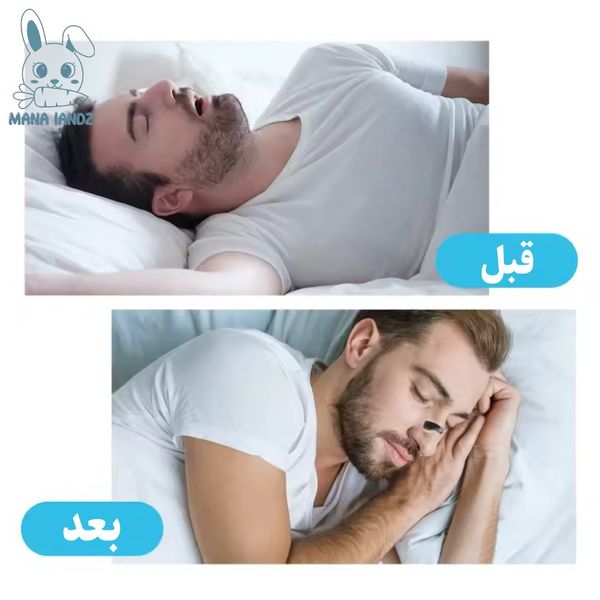 کیت گشاد کننده تنفسی بینی ورزش و خواب ( باز کننده بینی مگنتی)