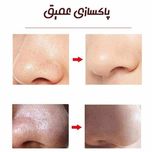 میکرودرم خانگی