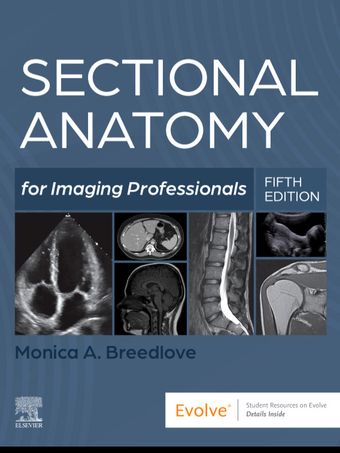 Sectional Anatomy for Imaging Professionals 2027