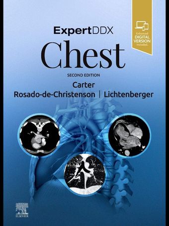 ExpertDDx: Chest 2nd Edition