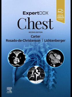 ExpertDDx: Chest 2nd Edition